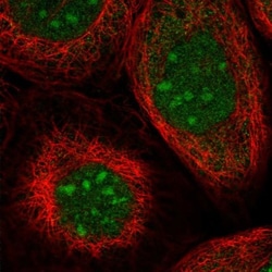 TRMT1L Antibody, Novus Biologicals:Antibodies:Primary Antibodies